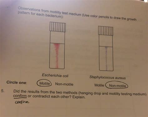 Observing Motility and Selective Media Study Guide 